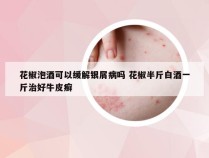花椒泡酒可以缓解银屑病吗 花椒半斤白酒一斤治好牛皮癣