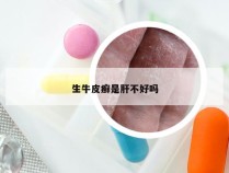 生牛皮癣是肝不好吗