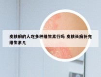 皮肤癣的人吃多种维生素行吗 皮肤长癣补充维生素几