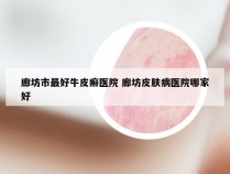 廊坊市最好牛皮癣医院 廊坊皮肤病医院哪家好