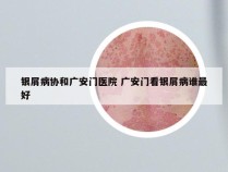 银屑病协和广安门医院 广安门看银屑病谁最好