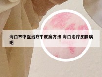 海口市中医治疗牛皮癣方法 海口治疗皮肤病吧
