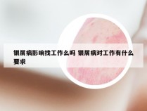 银屑病影响找工作么吗 银屑病对工作有什么要求