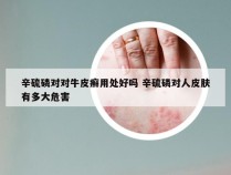 辛硫磷对对牛皮癣用处好吗 辛硫磷对人皮肤有多大危害