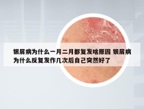 银屑病为什么一月二月都复发啥原因 银屑病为什么反复发作几次后自己突然好了