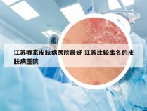 江苏哪家皮肤病医院最好 江苏比较出名的皮肤病医院