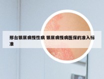 邢台银屑病慢性病 银屑病慢病医保的准入标准