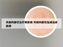 天麻钩藤饮治疗银屑病 天麻钩藤饮加减治顽固病