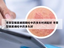 寻常型银屑病初期吃中药多长时间能好 寻常型银屑病吃中药多久好
