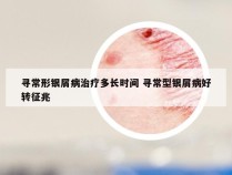 寻常形银屑病治疗多长时间 寻常型银屑病好转征兆