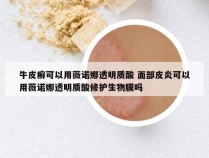 牛皮癣可以用薇诺娜透明质酸 面部皮炎可以用薇诺娜透明质酸修护生物膜吗