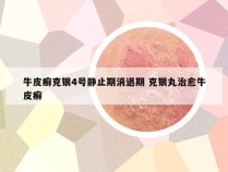 牛皮癣克银4号静止期消退期 克银丸治愈牛皮癣
