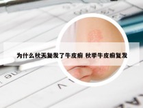 为什么秋天复发了牛皮癣 秋季牛皮癣复发