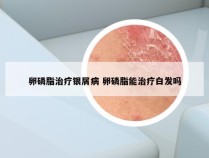 卵磷脂治疗银屑病 卵磷脂能治疗白发吗