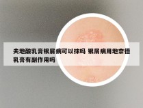 夫地酸乳膏银屑病可以抹吗 银屑病用地奈德乳膏有副作用吗