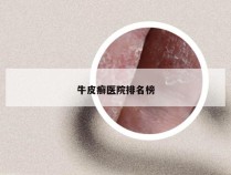 牛皮癣医院排名榜