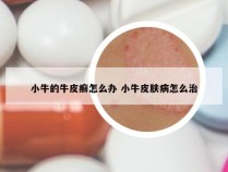 小牛的牛皮癣怎么办 小牛皮肤病怎么治