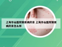 上海华山医院银屑病药膏 上海华山医院银屑病药膏怎么样