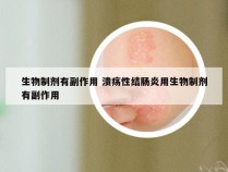 生物制剂有副作用 溃疡性结肠炎用生物制剂有副作用