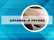 全球牛皮癣患者人数 世界牛皮癣日