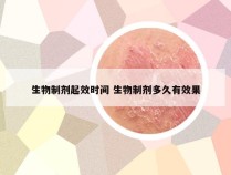 生物制剂起效时间 生物制剂多久有效果