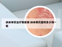 纳米单抗治疗银屑病 纳米银抗菌剂多少钱一瓶