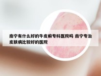 南宁有什么好的牛皮癣专科医院吗 南宁专治皮肤病比较好的医院