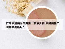 广东银屑病治疗费用一般多少钱 银屑病在广州哪里看最好?