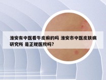 淮安有中医看牛皮癣的吗 淮安市中医皮肤病研究所 是正规医院吗?