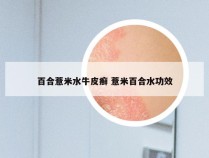 百合薏米水牛皮癣 薏米百合水功效
