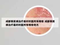 成都银屑病治疗最好的医院有哪些 成都银屑病治疗最好的医院有哪些地方