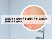 点滴型银屑病用青霉素还是红霉素 点滴型银屑病用什么抗生素
