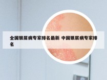 全国银屑病专家排名最新 中国银屑病专家排名