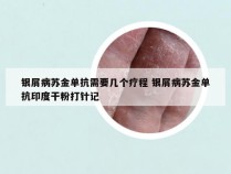 银屑病苏金单抗需要几个疗程 银屑病苏金单抗印度干粉打针记