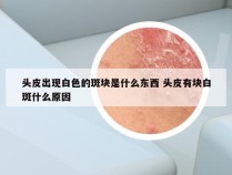 头皮出现白色的斑块是什么东西 头皮有块白斑什么原因