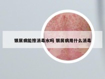 银屑病能擦消毒水吗 银屑病用什么消毒