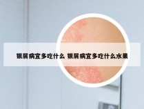 银屑病宜多吃什么 银屑病宜多吃什么水果