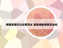 喝银屑病可以吃黄芪水 银屑病能喝黄芪水吗