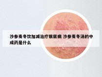 沙参麦冬饮加减治疗银屑病 沙参麦冬汤的中成药是什么