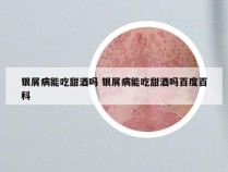 银屑病能吃甜酒吗 银屑病能吃甜酒吗百度百科