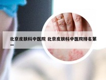 北京皮肤科中医院 北京皮肤科中医院排名第一