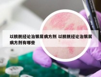 以膀胱经论治银屑病方剂 以膀胱经论治银屑病方剂有哪些