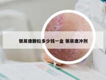 银屑康颗粒多少钱一盒 银屑康冲剂