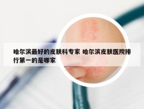 哈尔滨最好的皮肤科专家 哈尔滨皮肤医院排行第一的是哪家
