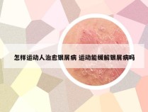 怎样运动人治愈银屑病 运动能缓解银屑病吗