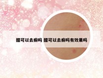 醋可以去癣吗 醋可以去癣吗有效果吗