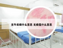 无牛皮癣什么意思 无癣是什么意思