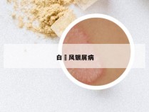 白癲风银屑病
