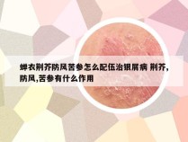 蝉衣荆芥防风苦参怎么配伍治银屑病 荆芥,防风,苦参有什么作用