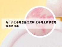 为什么上半身总是出皮癣 上半身上皮肤老是痒怎么回事
